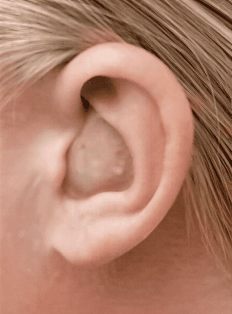 Close-up of an ear with hearing aid